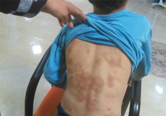 تنبیه وحشتناک دانش آموزان در ایران در+عکس تنبیه وحشتناک دانش آموزان در ایران در+عکس