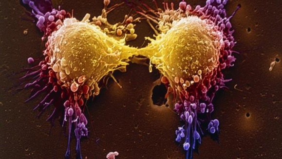 راز دانش: نقش مثبت تزریق ویتامین ث در مبارزه با سرطان