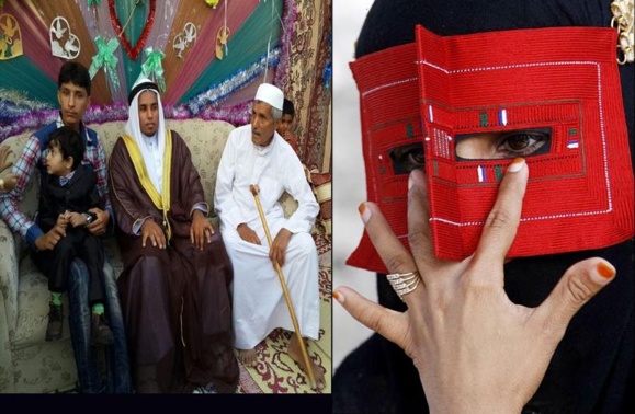 جسم يا قشم/گزارش جالبی از احمد امین غزي جسم يا قشم/گزارش جالبی از احمد امین غزي