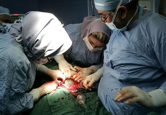 معایب و عوارض انجام عمل سزارین ومقایسه آن در ایران و آمریکا معایب و عوارض انجام عمل سزارین ومقایسه آن در ایران و آمریکا