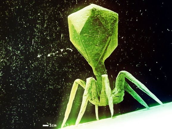 کشف ویروس خطرناکی که در روده ی نیمی از ساکنان کره زمین زندگی می کند کشف ویروس خطرناکی که در روده ی نیمی از ساکنان کره زمین زندگی می کند