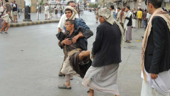 دهها کشته ومجروح تاوان ماجراجویی گروه الحوثی واشغال پایتخت یمن دهها کشته ومجروح تاوان ماجراجویی گروه الحوثی واشغال پایتخت یمن