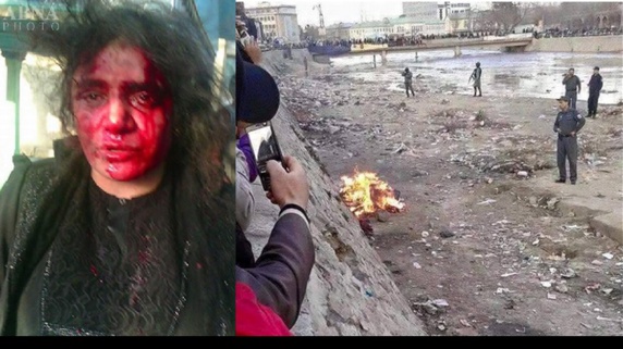 زنده سوزاندن اين بار در مرکز شهر کابل پایتخت افغانستان زنده سوزاندن اين بار در مرکز شهر کابل پایتخت افغانستان