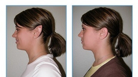 معیار زیبایی در ایران: گوش الاغی، بینی عقابی، فک سگی معیار زیبایی در ایران: گوش الاغی، بینی عقابی، فک سگی