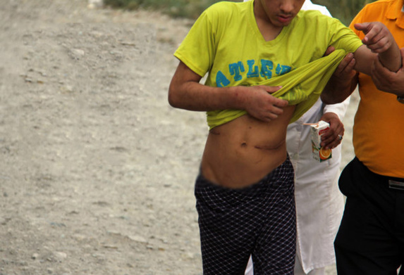 روایت تکان دهنده از رفتار غير انسانى وشکنجه معلولان در پایتخت ایران/ استفاده از غل و زنجیر و سگ روایت تکان دهنده از رفتار غير انسانى وشکنجه معلولان در پایتخت ایران/ استفاده از غل و زنجیر و سگ