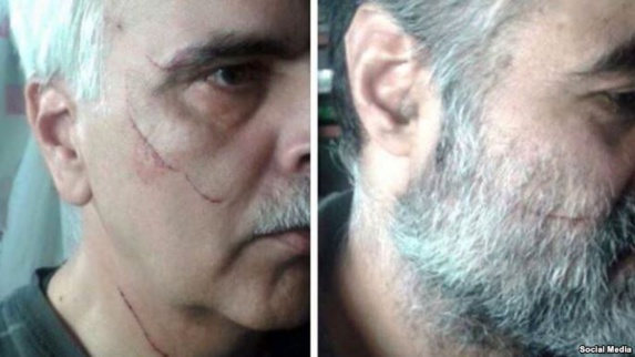 سعید رضوی فقیه، سمت راست و سعید مدنی سمت چپ مورد حمله قرار گرفته اند.
