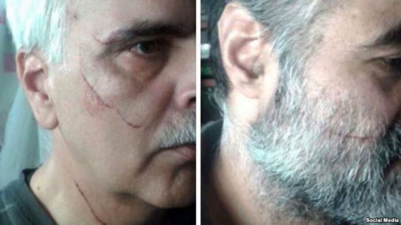 سعید رضوی فقیه، سمت راست و سعید مدنی سمت چپ مورد حمله قرار گرفته اند. سعید رضوی فقیه، سمت راست و سعید مدنی سمت چپ مورد حمله قرار گرفته اند.