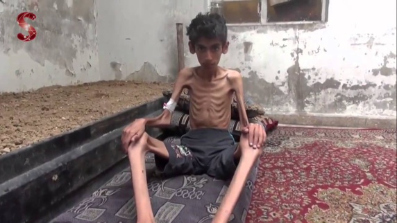 فاجعه انسانی؛ خطر مرگ ده‌ها هزار سوری بر اثر گرسنگی