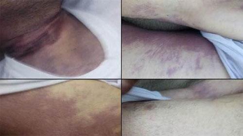 آثار شکنجه‌ بر جسد پاسدار کشته شده توسط حفاظت اطلاعات سپاه پاسداران