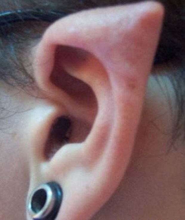 استقبال وسیع جوانان مرفه تهرانی از عمل زیبایی گوش الاغی استقبال وسیع جوانان مرفه تهرانی از عمل زیبایی گوش الاغی