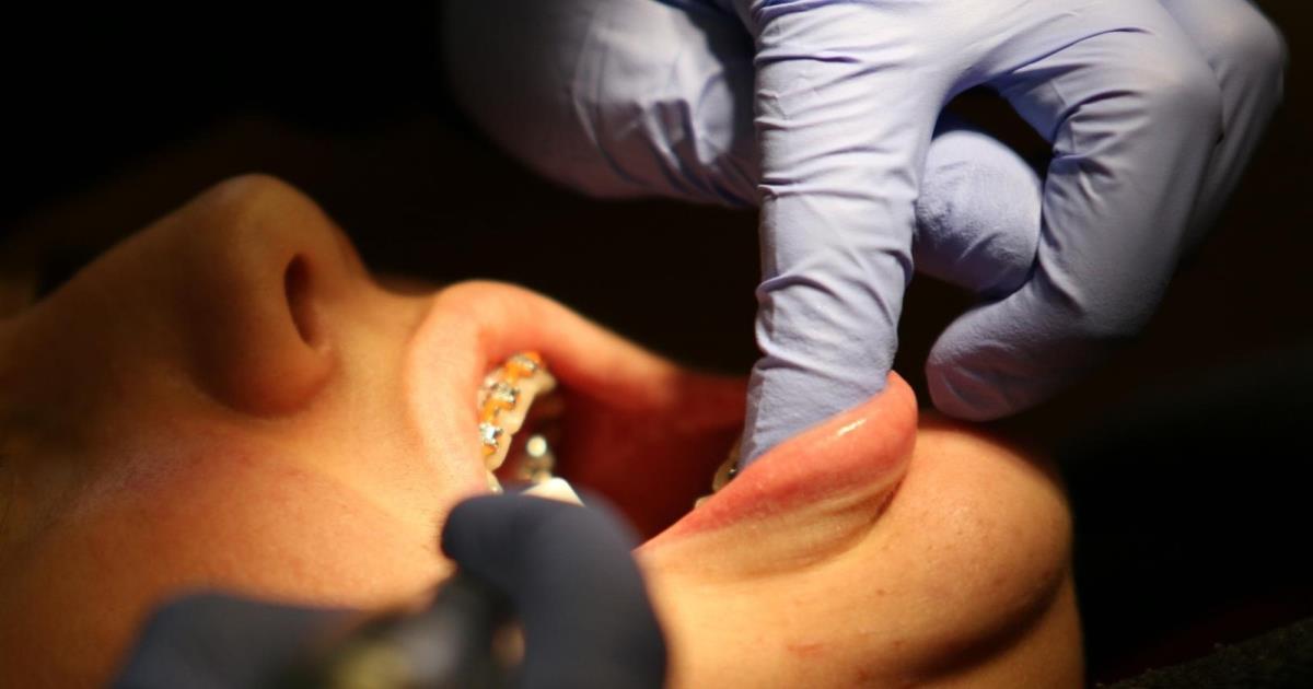 خميردندان سفيدکننده براي دندان ضرر دارد خميردندان سفيدکننده براي دندان ضرر دارد