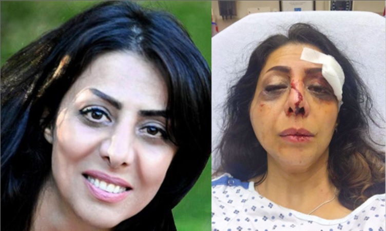 حمله داعشانه عوامل رژیم تهران در واشنگتن به  یک روزنامه نگار زن وفعال حقوق بشری حمله داعشانه عوامل رژیم تهران در واشنگتن به  یک روزنامه نگار زن وفعال حقوق بشری