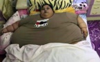 عمل جراحی موفق برای چاق ترین زن جهان + ویدیو