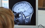 کشف «لکه سیاه» و لانه شیطان در مغز انسان