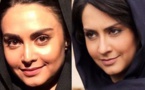 ابراز پشیمانی بازیگر زن ایرانی از جراحی بینی خود؛ خدارحمی: ریسک بزرگی کردم + تصاویر